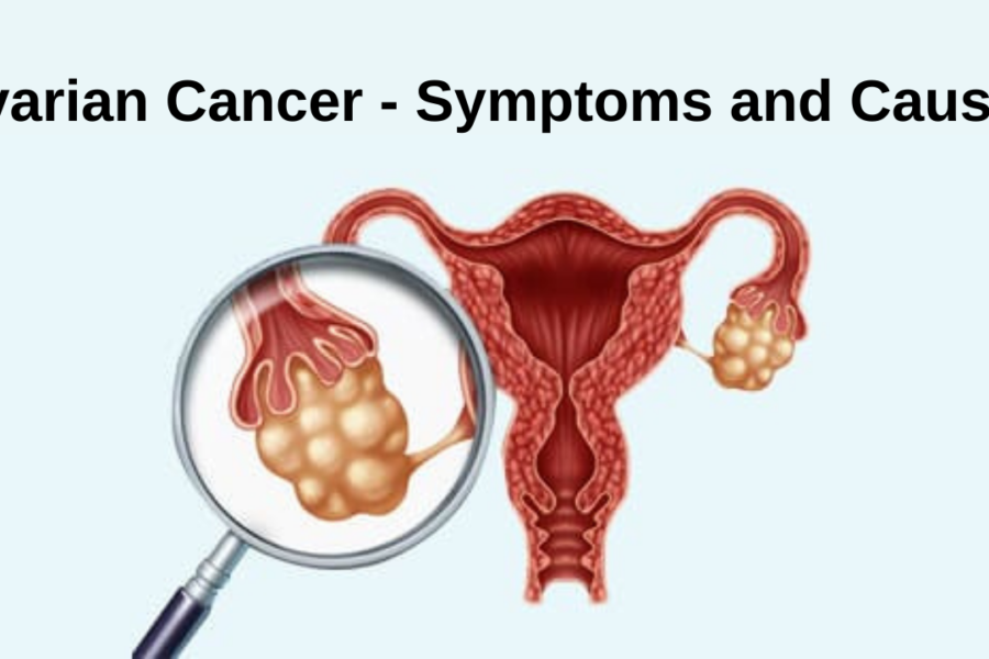 Ovarian Cancer - Symptoms and Causes